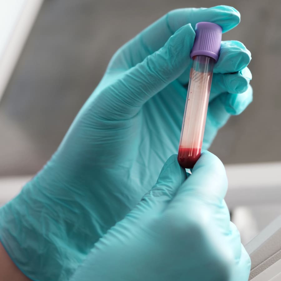 Blood sample taken at our Veterinary Diagnostic Lab in La Mesa